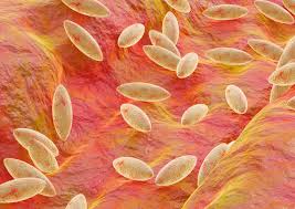 Maladies dues à Brucella